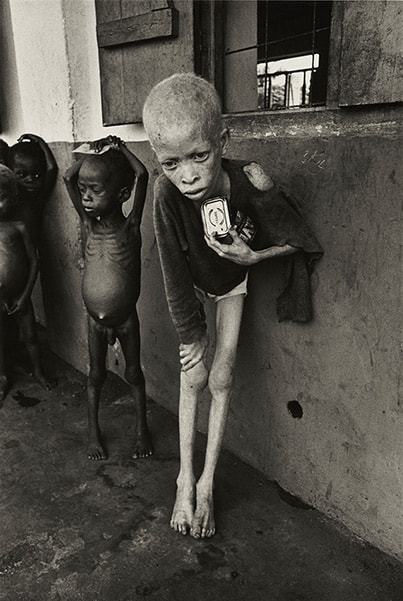 Don McCullin, Albino Boy, Bafra, 1969